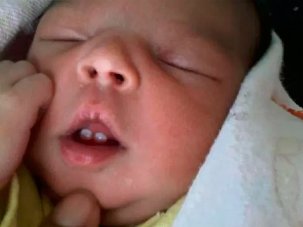 Rafaela Alanda vai passar por exame de raio-x para saber se os dentes vão ser retirados (Foto: Arquivo/Pessoal)