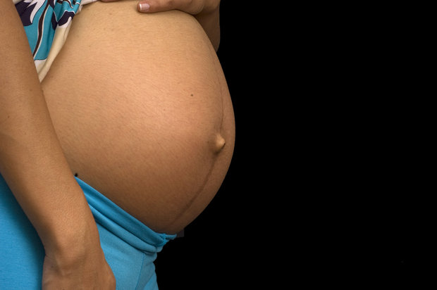 Segundo a OMS, outro dado preocupante é que 31 países latino-americanos têm transmissões locais de zika (Foto: EBC)
