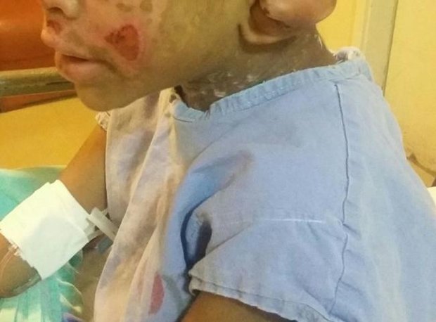 Menino está internado e deve receber alta no final de semana (Foto: Divulgação)