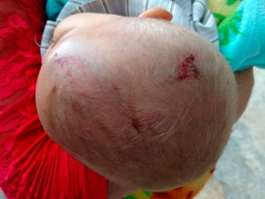 Um outro sobrinho do acusado, um bebê de 10 meses, também foi agredido a pauladas (Foto: Augusto Urgente) Um outro sobrinho do acusado, um bebê de 10 meses, também foi agredido a pauladas (Foto: Augusto Urgente)