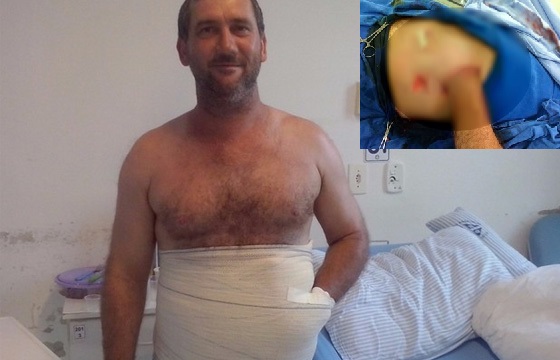 Carlos Mariotti sofreu acidente em uma máquina de trabalho (Foto: Analuze Goulart/Arquivo Pessoal)