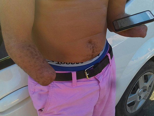 Homem com as mãos amputadas é flagrado ao dirirgir carro na BR-101, na Bahia (Foto: PRF / Divulgação)
