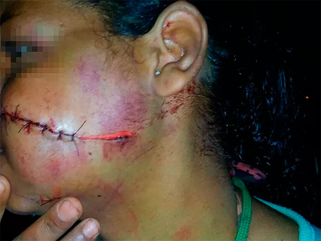 Mulher teve o rosto cortado durante uma briga com o marido (Foto: Reprodução | Blog do Braga)