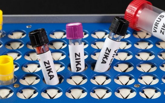 Eles serão disponibilizados para gestantes, bebês filhos de mães com diagnóstico de infecção e recém-nascidos com malformação