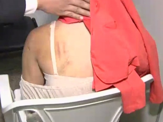 Adolescente foi torturada, agredida e esfaqueada por rivais (Foto: Reprodução/TV Anhamguera) Adolescente foi torturada, agredida e esfaqueada por rivais (Foto: Reprodução/TV Anhamguera)