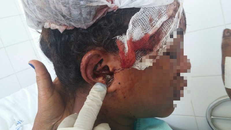 Segundo informações da polícia, o universitário Caique Malta Arouca, torturou e tentou matar Emily Carolina dos Santos Silva, de 18 anos