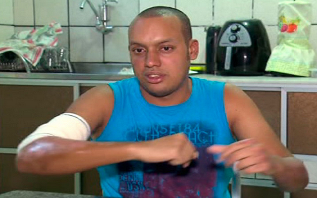 O funcionário da farmácia saiu no meio das chamas e conta que foi a única forma de se salvar. (Foto: Reprodução/Record TV Itapoan)