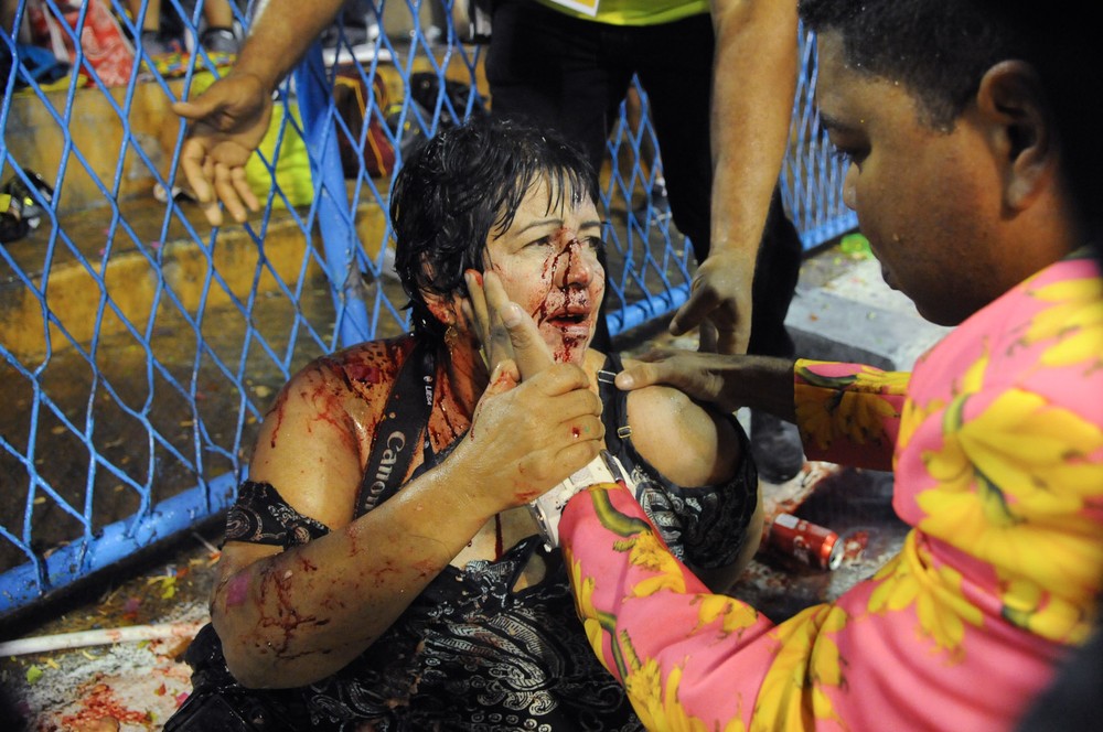Uma das pessoas feridas no acidente da Paraíso do Tuiuti (Foto: Alexandre Durão/G1)