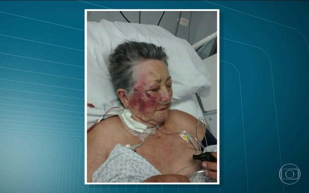 A idosa de 78 anos foi espancada por enfermeiro dentro de UTI de hospital de São Paulo, na madrugada de domingo (16) (Foto: Reprodução/TV Globo)