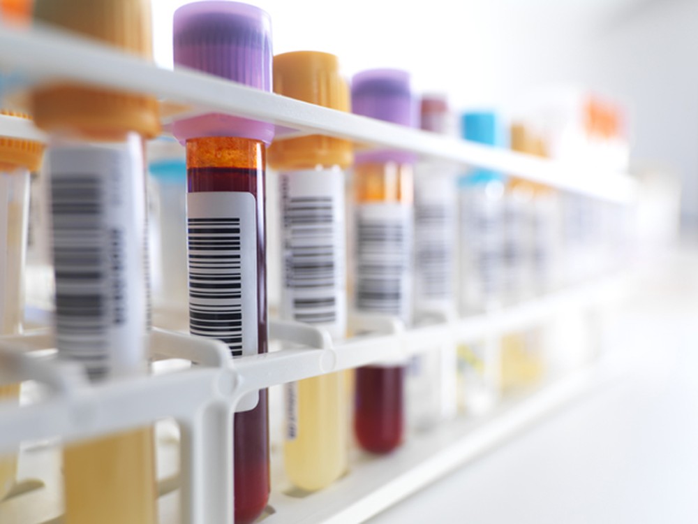 Descoberta pode levar a exame de sangue para detectar sinais de câncer (Foto: Science Photo Library) Descoberta pode levar a exame de sangue para detectar sinais de câncer (Foto: Science Photo Library)
