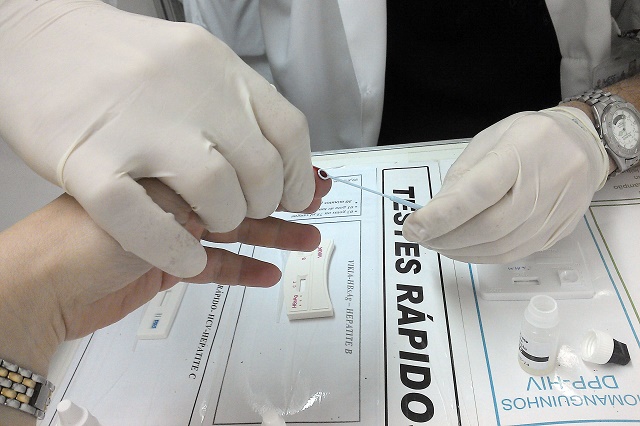 Saber do contágio pelo HIV precocemente aumenta a expectativa de vida do soropositivo Saber do contágio pelo HIV precocemente aumenta a expectativa de vida do soropositivo