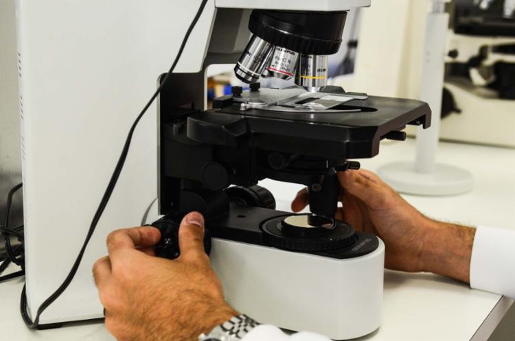 Cientistas já suspeitavam que, antes de se espalhar, os melanomas 'preparavam o terreno' nos órgãos (Foto: Rovena Rosa | Agência Brasil)