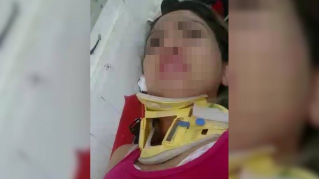 A jovem sofreu lesões graves na bacia e pode ter os movimentos das pernas comprometidos A jovem sofreu lesões graves na bacia e pode ter os movimentos das pernas comprometidos