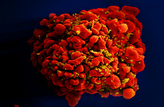 Célula infectada por partículas do vírus HIV, anexas à superfície (Foto: National Institute of Allergy and Infectious Diseases (NIAID))