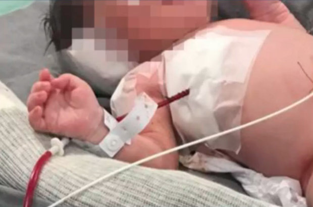 Arthur tinha um mês de vida e estava internado no CTI de um hospital no Rio (Foto: Reprodução)