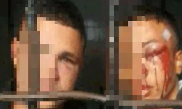 'Nada justifica', diz mãe, afirmando que filho foi espancado. Delegado se recusou a fazer B.O. (Foto: Reprodução) 'Nada justifica', diz mãe, afirmando que filho foi espancado. Delegado se recusou a fazer B.O. (Foto: Reprodução)