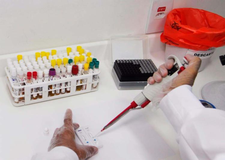 Bahiafarma produz testes rápidos para zika, dengue e chikungunya (Foto: Ascom | Sesab)