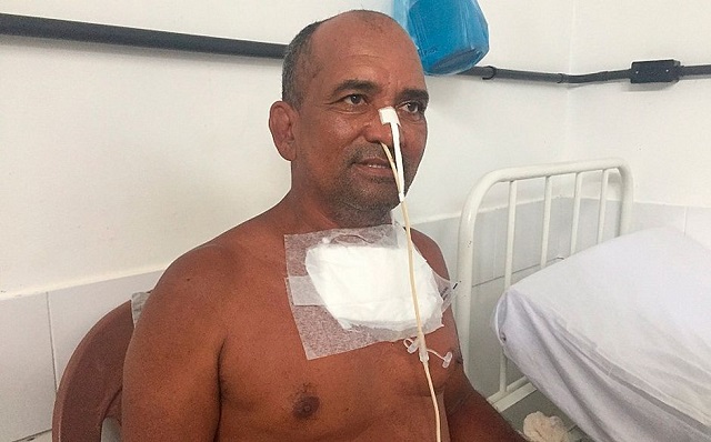 Ele estava dormindo quando incidente ocorreu: 'Perdi o fôlego', diz em vídeo Ele estava dormindo quando incidente ocorreu: 'Perdi o fôlego', diz em vídeo