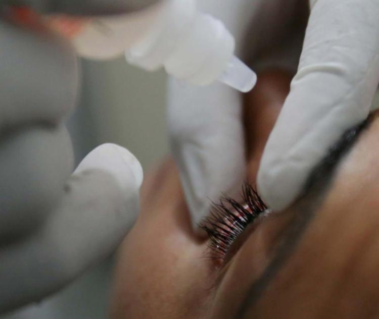 Uso de colírio é uma das indicações de tratamento da doença (Foto: Adilton Venegeroles | Ag. A TARDE)