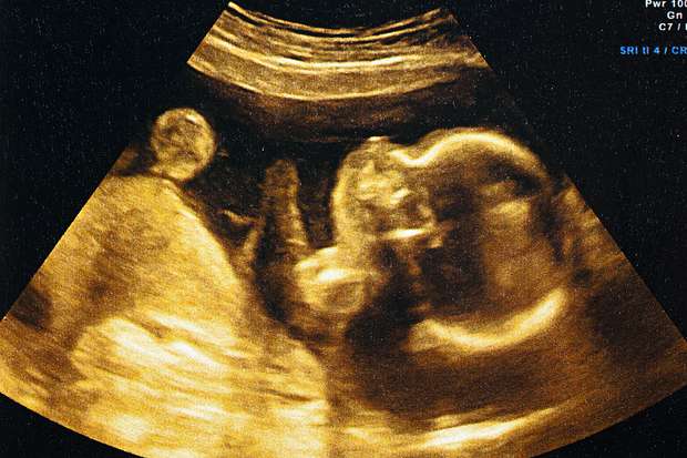 Foto: Getty Images