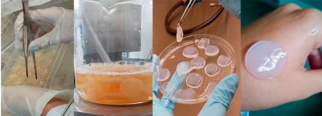 Proteína do abacaxi potencializa cicatrização de ferimentos, queimaduras e até de feridas ulcerativas  (Foto: Divulgação)