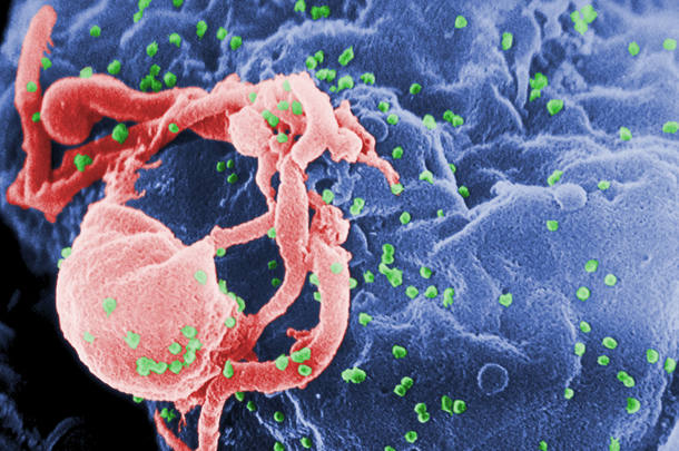 Célula infectada por partículas do vírus HIV, anexas à superfície (Foto: National Institute of Allergy and Infectious Diseases)