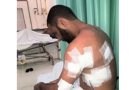 Marcelo ainda está se recuperando (Foto: Reprodução)