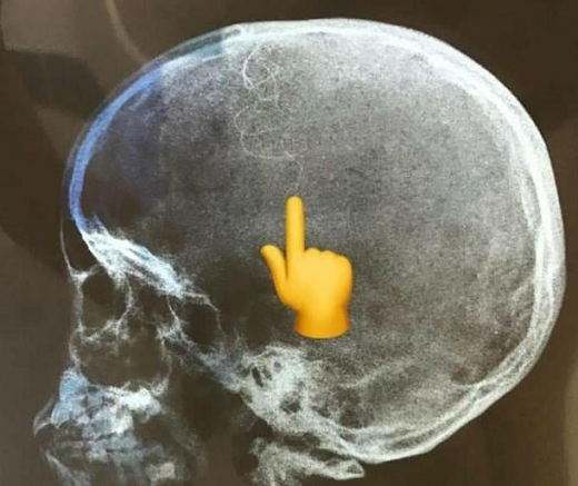 (Foto: Reprodução | Boca no Trombone PG)