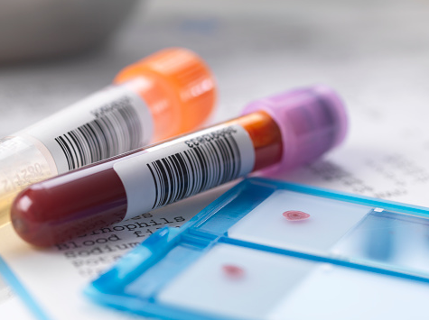 O novo subtipo pertence ao grupo “M” do HIV, e é tido como a versão mais comum da doença em todo o mundo (Foto: Reprodução)