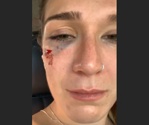 Mulher relata agressão de sócio e seguranças de casa de shows em Lauro de Freitas