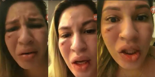 Milena Bemfica gravou vídeos em sua conta pessoal do Instagram denunciando agressões físicas que atribui ao marido (Foto: Reprodução)