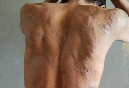 Há 29 presos internados no hospital, com doenças diversas (Foto: Reprodução)