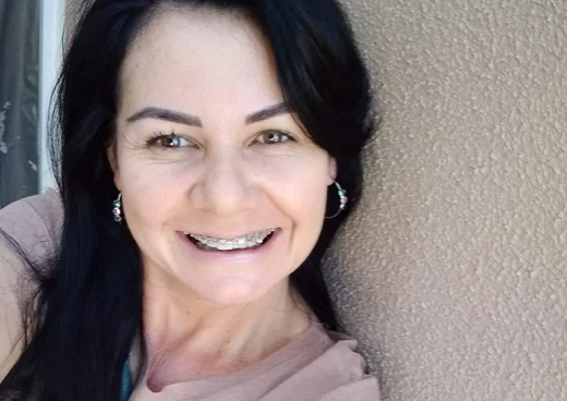 Elizangela Moraes, de 44 anos, foi baleada no rosto e no pescoço (Foto: Reprodução)