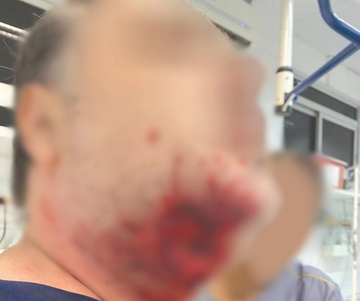 Médico foi agredido com uma mordida no pescoço (Foto: Reprodução)