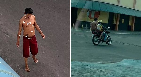 Homem deixou a unidade médica ainda com eletrodos colados pelo corpo durante um surto (Foto: Reprodução)