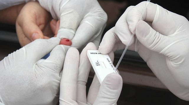 Testes rápidos será feito somente nas pessoas que atenderem os critérios pré-estabelecidos pelo Ministério da Saúde (Foto: Reprodução | Ascom/PMC)