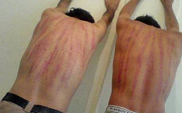 Moradores da comunidade denunciam agressões a quem está nas ruas após as 19h30 (Foto: Reprodução)
