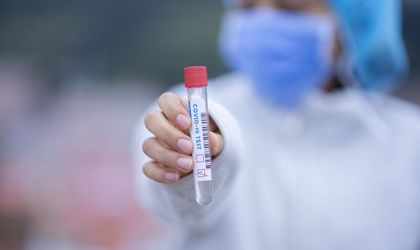 Mesmo sem o registro, testes foram distribuídos pelo Ministério da Saúde a diversos estados do país (Foto: Reprodução)