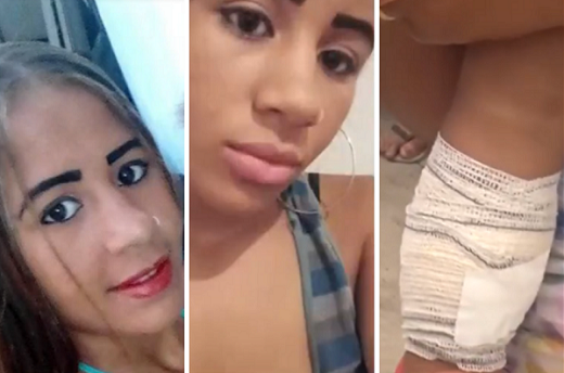 Filha de um ano da vítima, que estava no colo no momento do ataque, e a mãe da adolescente ficaram feridas (Fotos: Reprodução | TV Bahia)