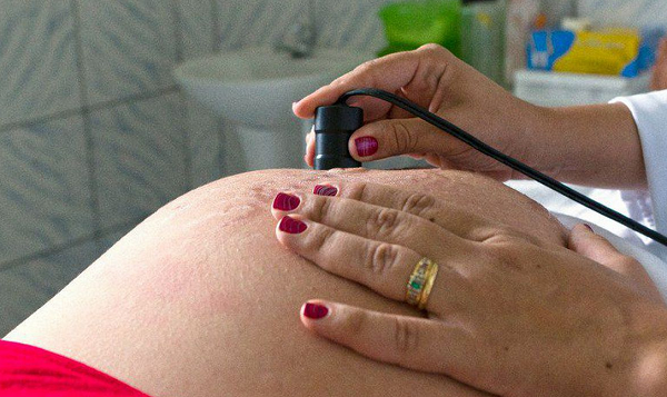 A entidade avalia que o resultado é consequência de mudanças na estrutura etária populacional e no comportamento reprodutivo (Foto: Reprodução)
