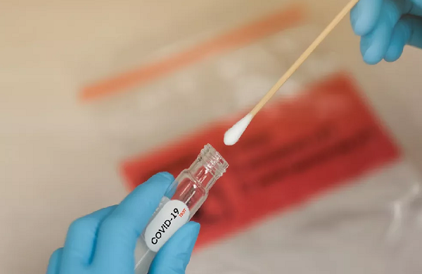 A fundação identificou a presença de linhagens distintas do vírus SARS-CoV2 nas amostras coletadas (Foto: Reprodução)