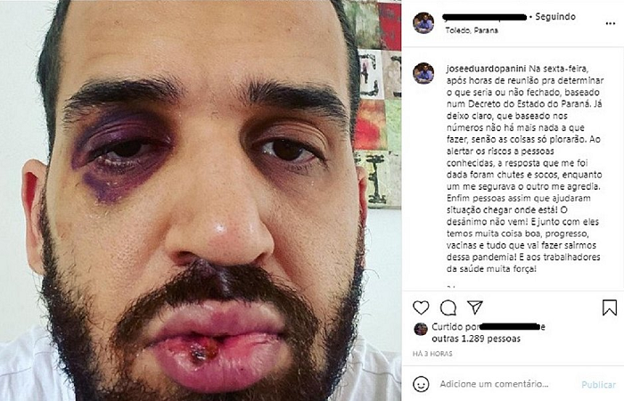 José Eduardo Mainart foi agredido por socos e chutes enquanto tentava convencer um parente e outro colega a não irem para uma festa (Foto: Reprodução)
