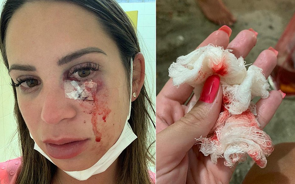 Psicóloga Valentina Baldino, 30 anos (Foto: Reprodução)