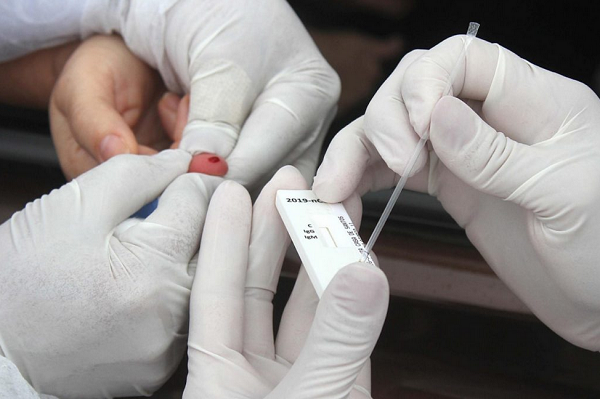 Maranhão é o terceiro estado a notificar investigações. O Ceará também apura uma contaminação (Foto: Reprodução)