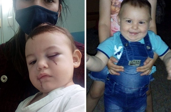 Pequeno Henryque, de 1 ano e 8 meses, ferido no ataque a creche (Foto: Reprodução)