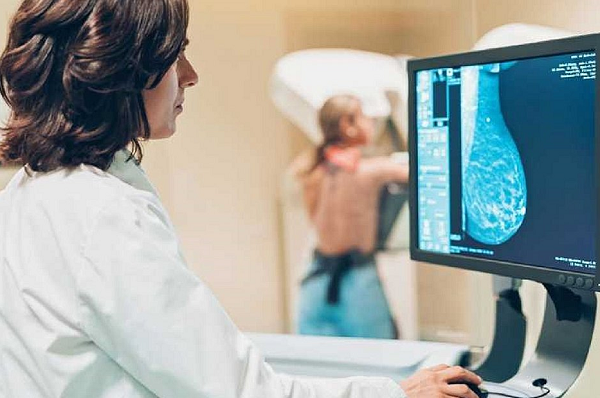 Mulheres acima de 40 anos devem fazer o exame de mamografia anualmente (Foto: Reprodução)