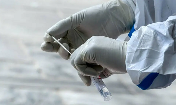 Infecção pela nova cepa ocorreu em uma pessoa que viajou recentemente ao México (Foto: Reprodução)