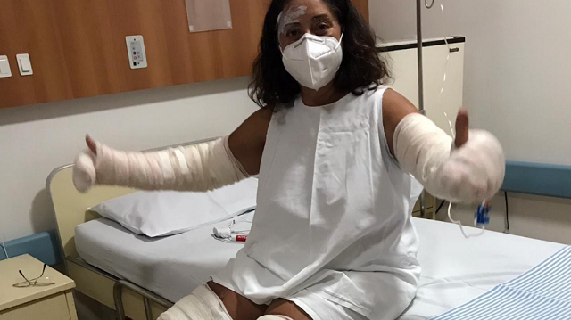 Marlene Moreira em hospital de Anápolis; ela sofreu acidente após jogar embalagem de desodorante no fogo (Foto: Arquivo Pessoal)