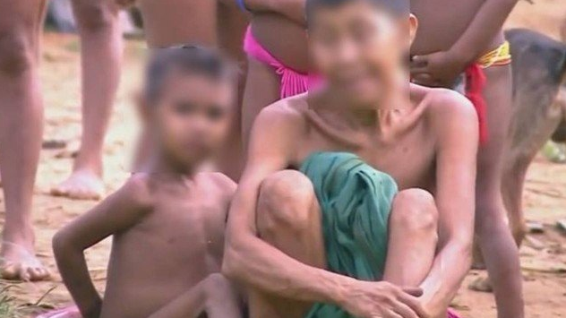 MPF afirma que há mais crianças ianomâmis desnutridas do que saudáveis (Foto: Reprodução)