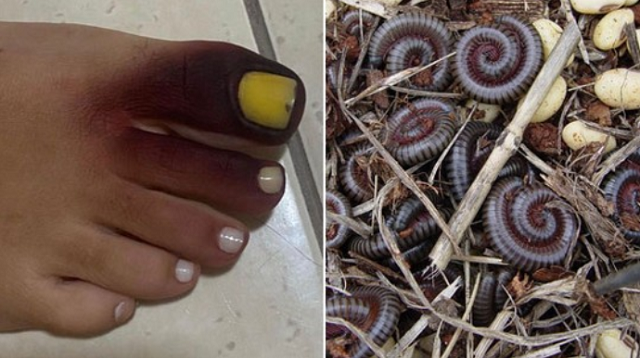 Gongolo, também conhecido como piolho-de-cobra, foi responsável pela reação química (Foto: Reprodução/Instagram)